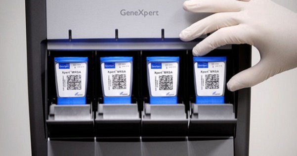 Indian Government To Tackle Tuberculosis With 300 New GeneXpert ...