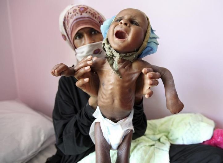 10 Hungriest Countries | 10 Most Starving Countries