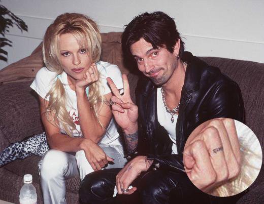 Pamela Anderson reveals her ex Tommy Lee also cured of Hepatitis C   National  Globalnewsca