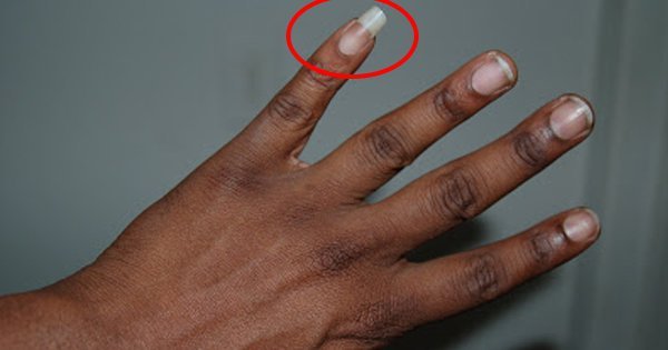 Why Do People Paint Their Pinky Nail a Different Color? - wide 4