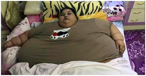 At 500 Kgs, This Egyptian Woman Is The Fattest Woman Alive