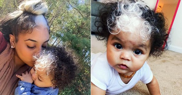 This Baby Was Born With The Same Streak Of White Hair As Her Mom Is Sporting It Like A Rockstar