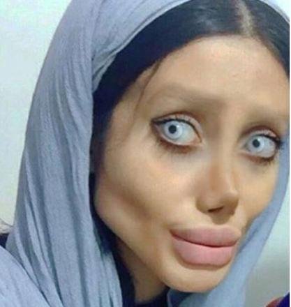This Iranian Woman Went Through 50 Surgeries In A Bid To Look Like Angelina  Jolie