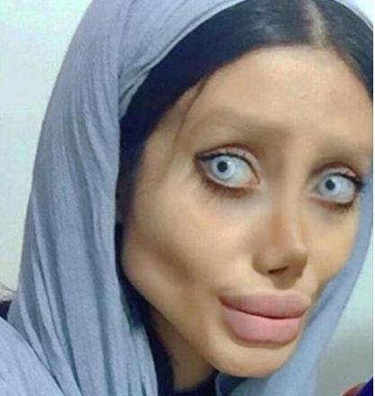 Angelina Jolie Hard Core Sex - This Iranian Woman Went Through 50 Surgeries In A Bid To Look Like Angelina  Jolie