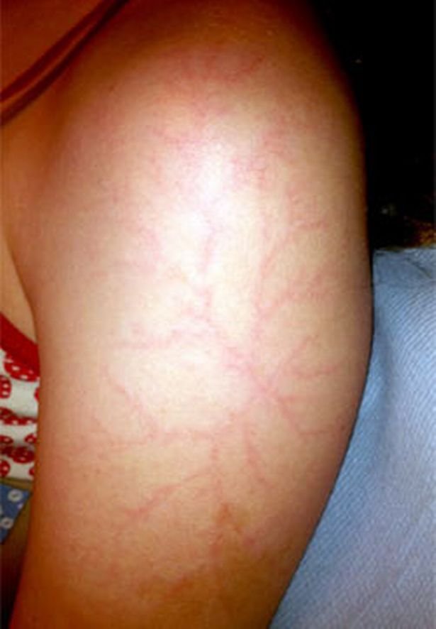 Pretty Lightning Scars 