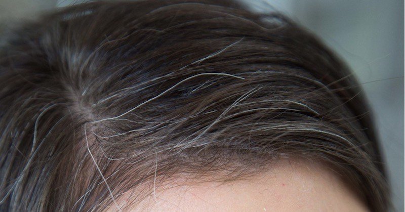 10 Natural Ways To Deal With Premature Greying Of Hair