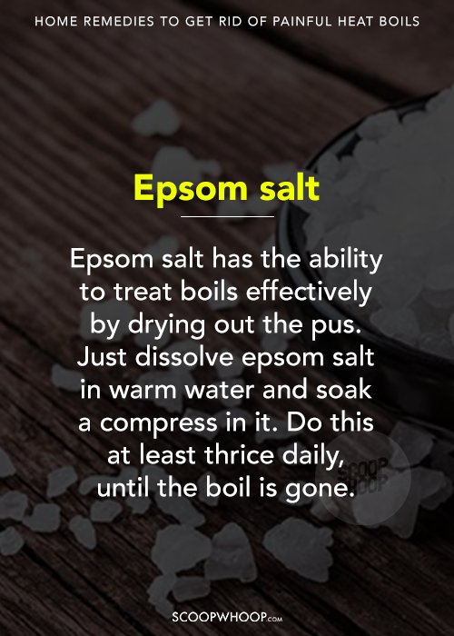 6 Home Remedies To Get Rid Of Painful Heat Boils ScoopWhoop