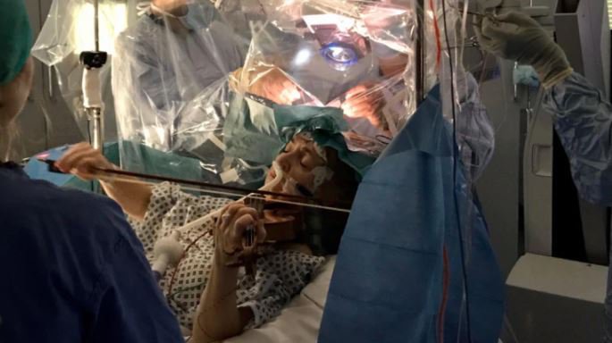 Woman Plays Violin While Being Operated For Brain Tumour To Preserve ...