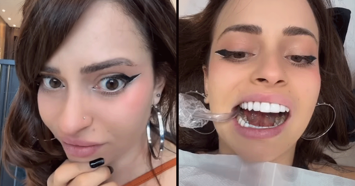 This Instagram Influencer Got A Tongue Surgery To Kiss Better, And Well