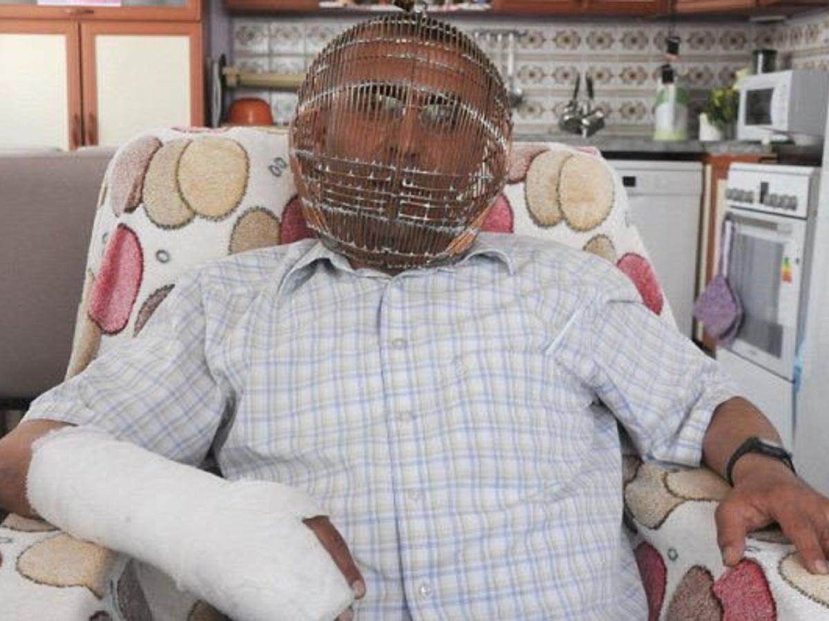 Turkish man  once locked his head in a cage to quit smoking