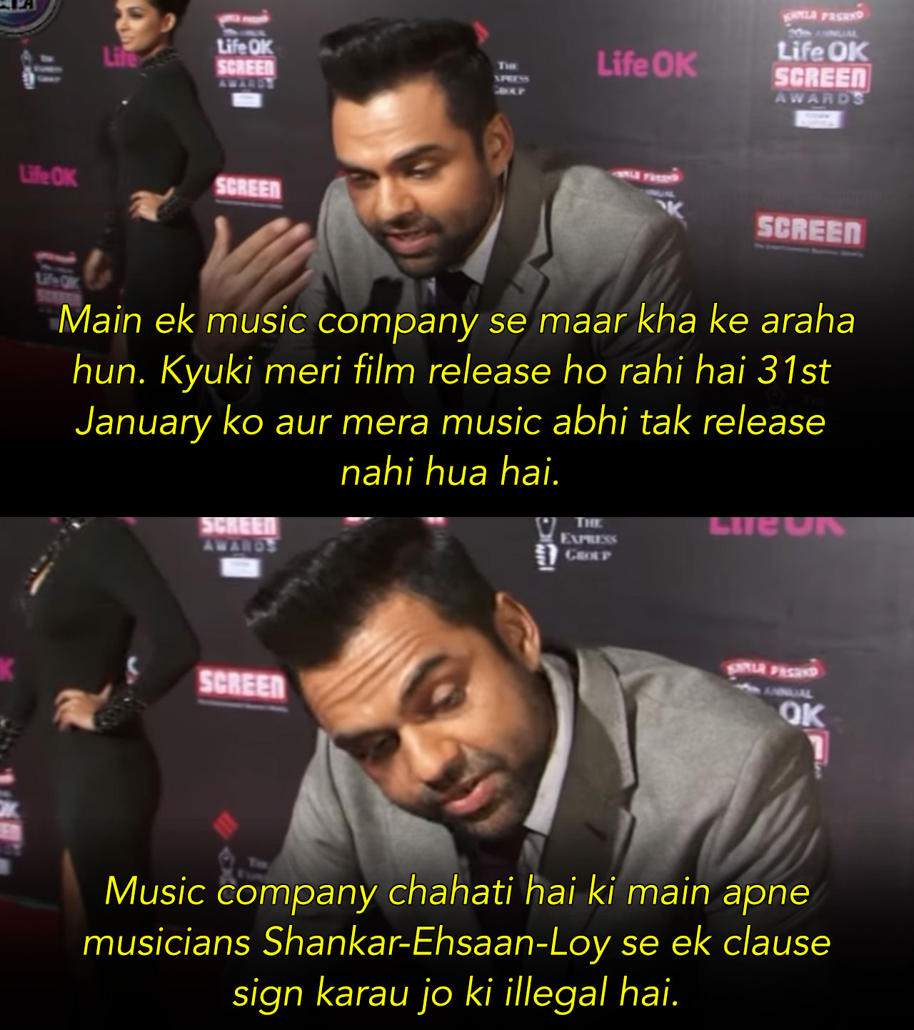 Abhay Deol black eye