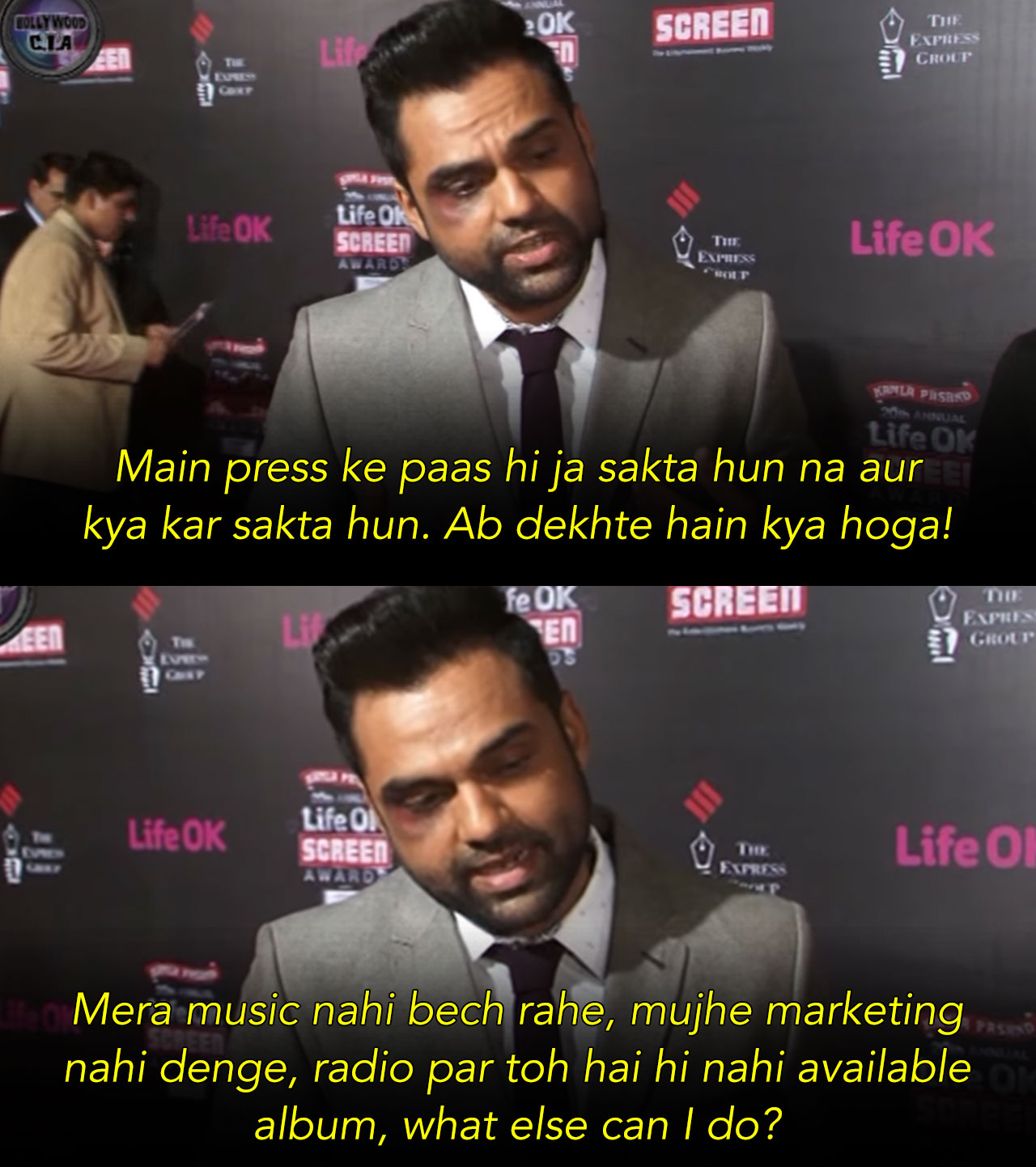 Abhay Deol black eye on award function