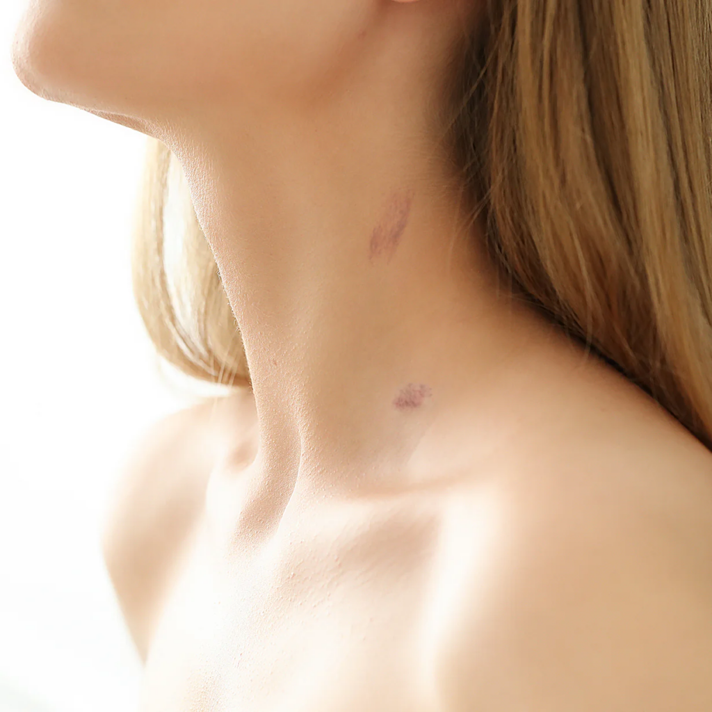 How to give a hickey