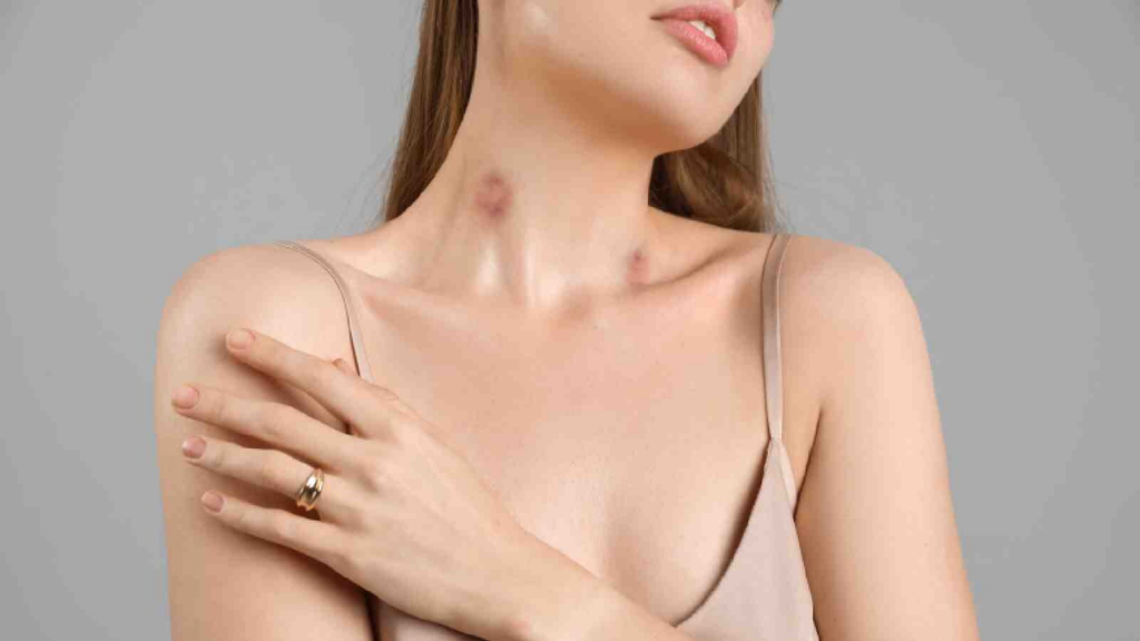 How to give a hickey