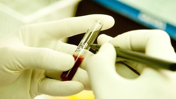 Close-up of blood sample testing in lab